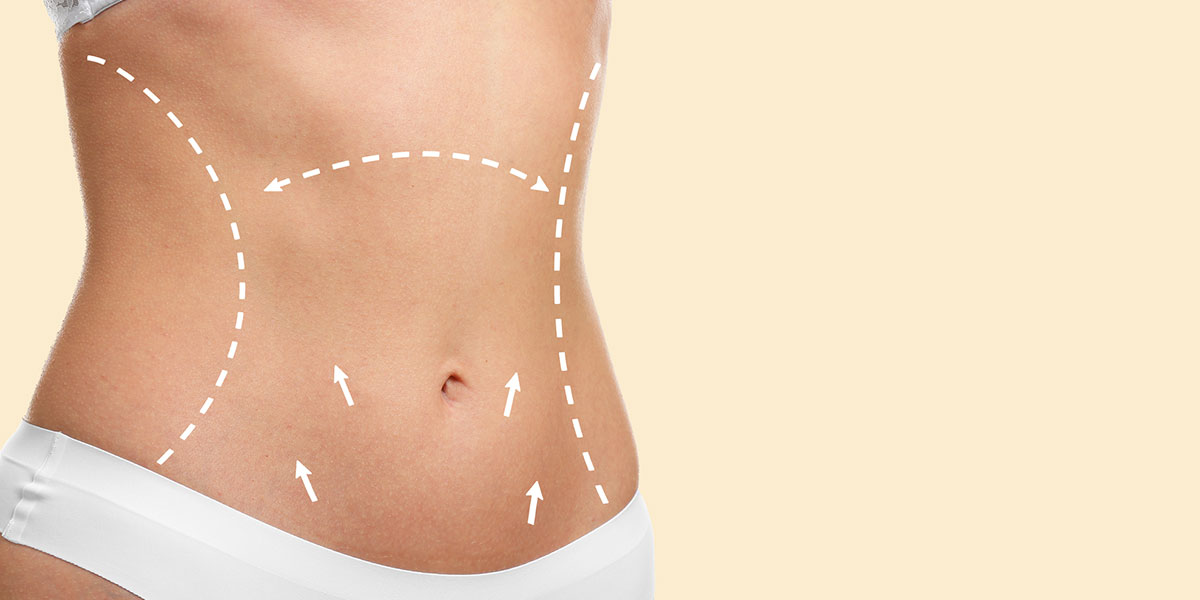 8 Basic Tips For Drainless Tummy Tuck Recovery