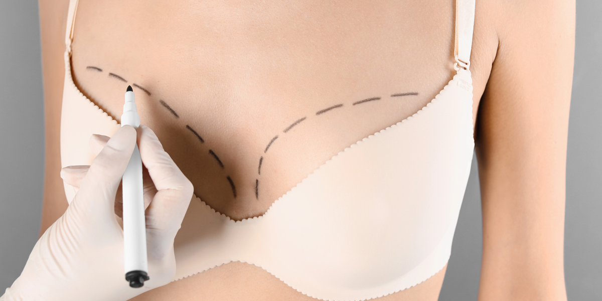 How To Know If You Need A Breast Lift Procedure