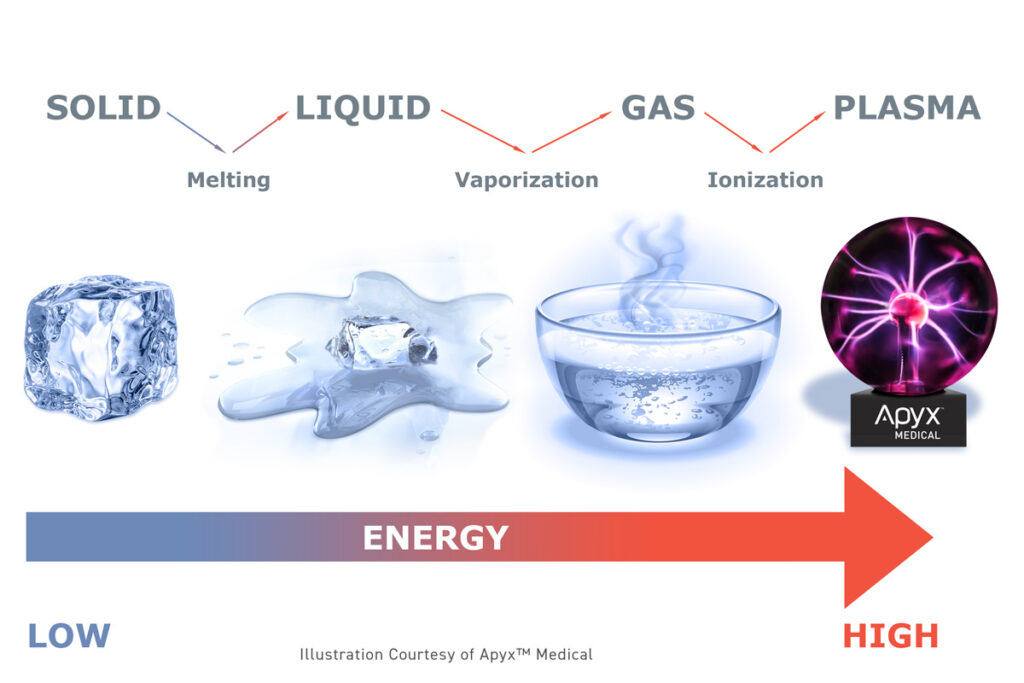 apyx-medical_renuvion_states_of_matter_wwm-courtesy-apyx_72dpi